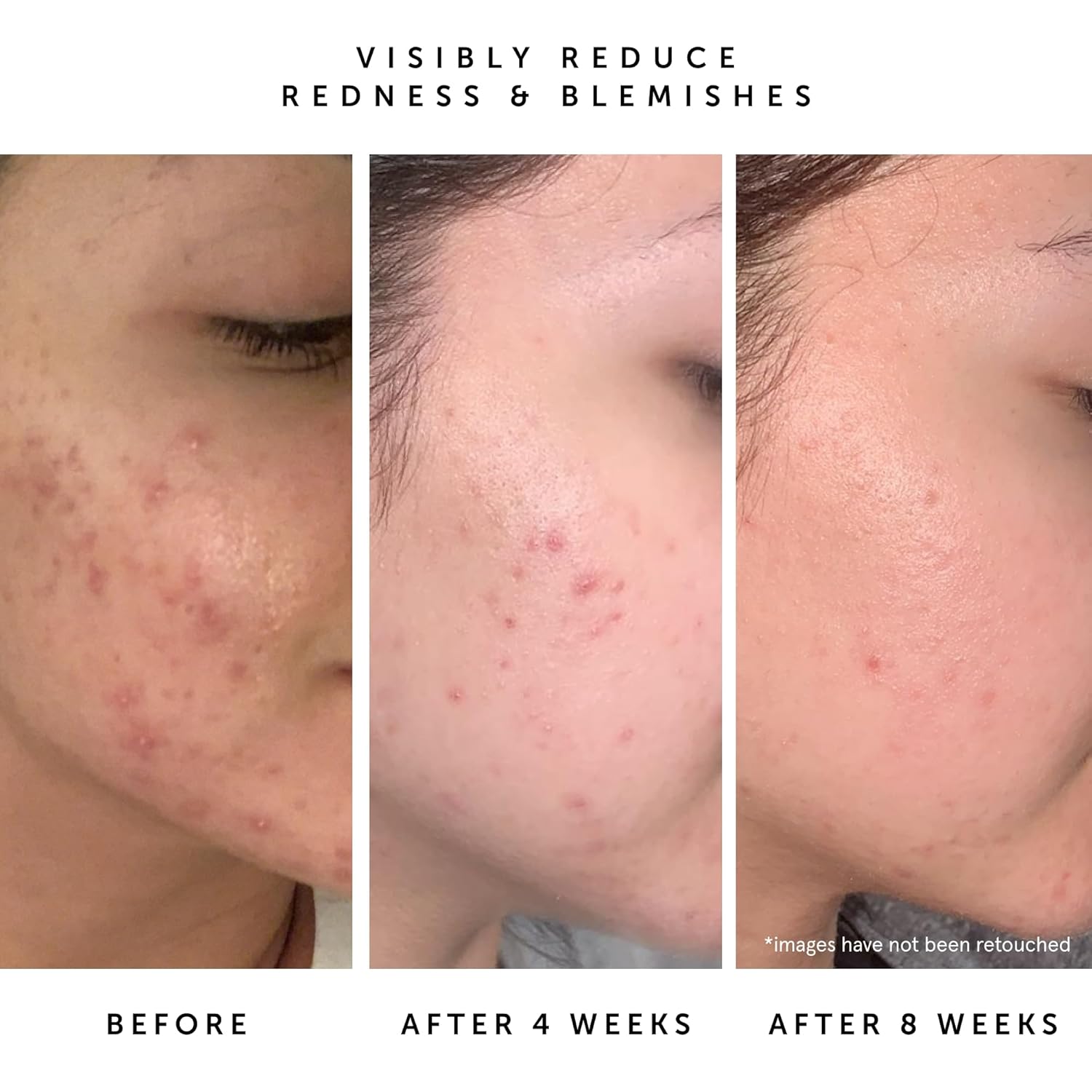 HERBIVORE Lapis Facial Oil | Balances Oil & Soothes Redness with Blue Tansy & Squalane | Safe for Oily & Acne Prone Skin, Non-Comedogenic, Vegan - Image 5