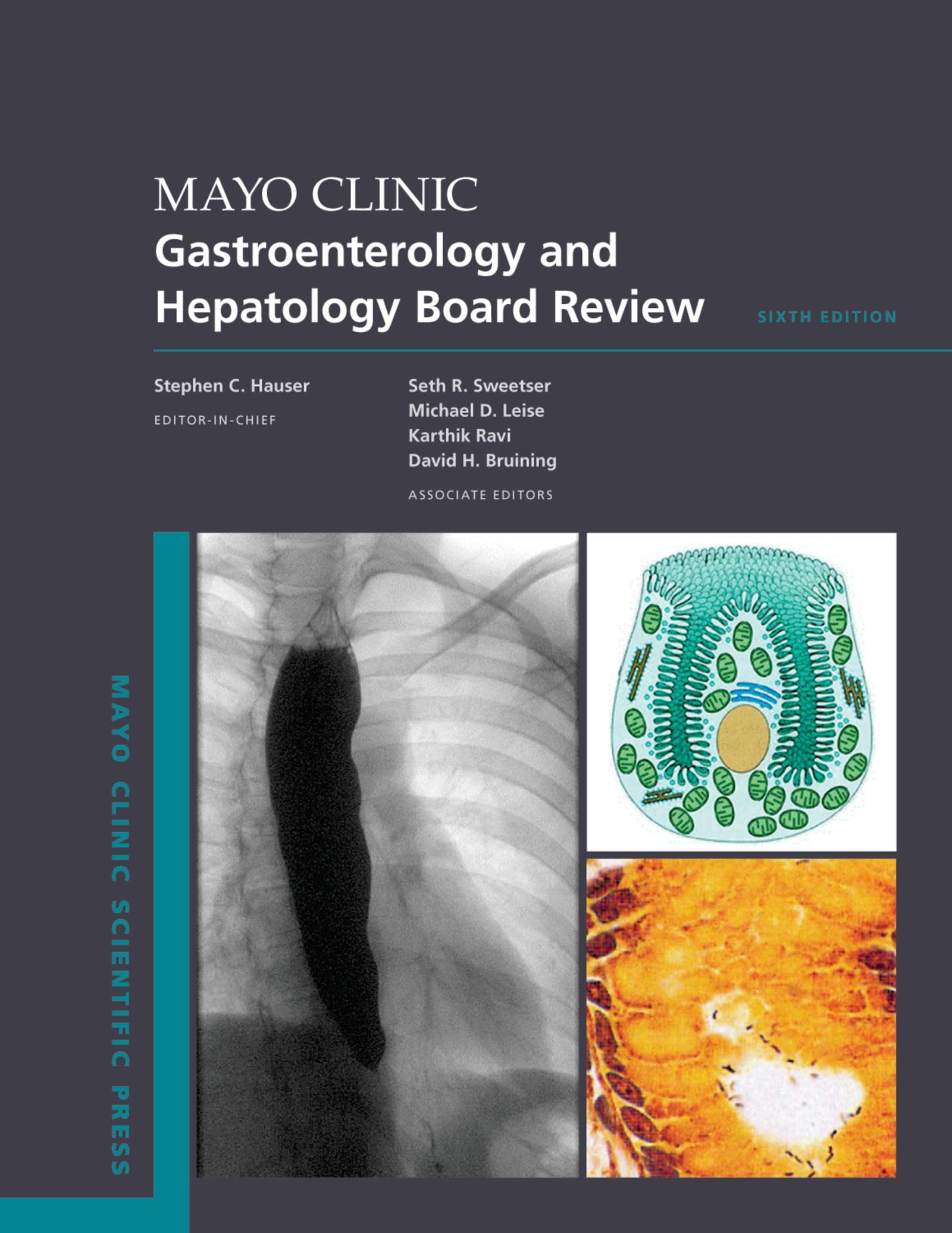 Mayo Clinic Gastroenterology and Hepatology Board Review (Mayo Clinic Scientific Press) (English Edition)