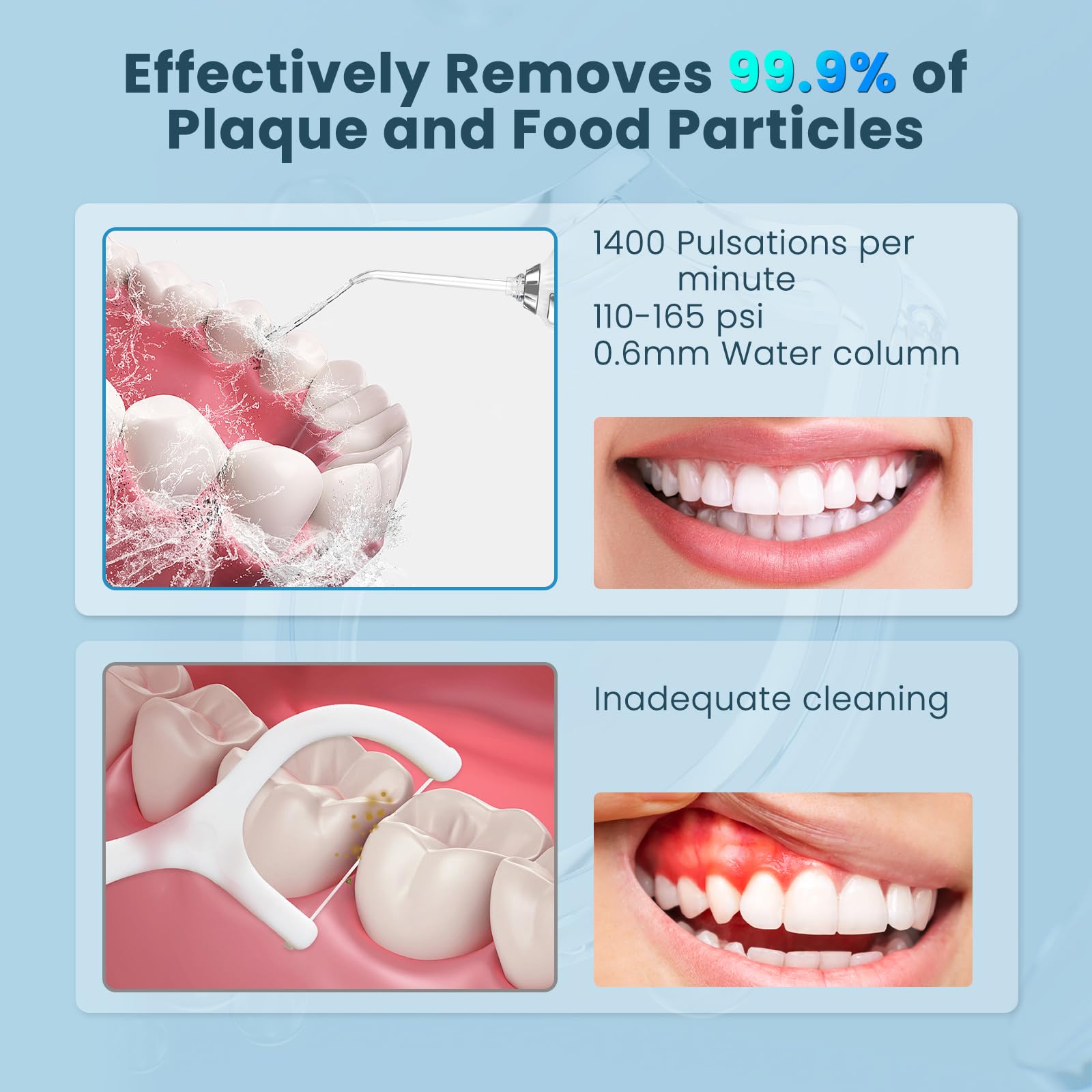 Irrigatore orale portatile senza fili, 5 modalità di irrigatore orale per denti con serbatoio da 300 ml, con 5 punte a getto, IPX7, impermeabile, ricaricabile, per casa e viaggio