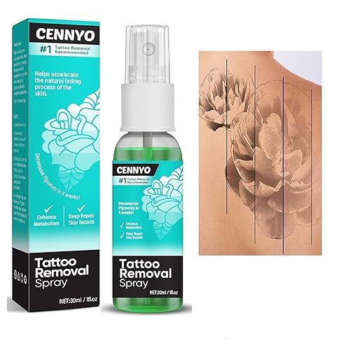 Eliminación de tatuajes-Spray del retiro de la decoloración del tatuaje, retiro casero del tatuaje, removedor sin dolor del tatuaje