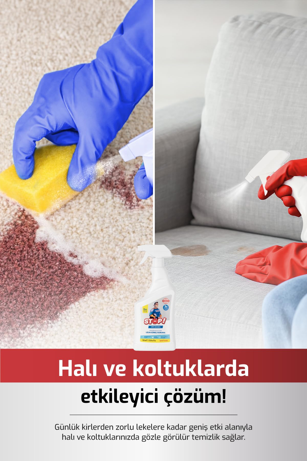 Stop Forte Leke Çıkarıcı