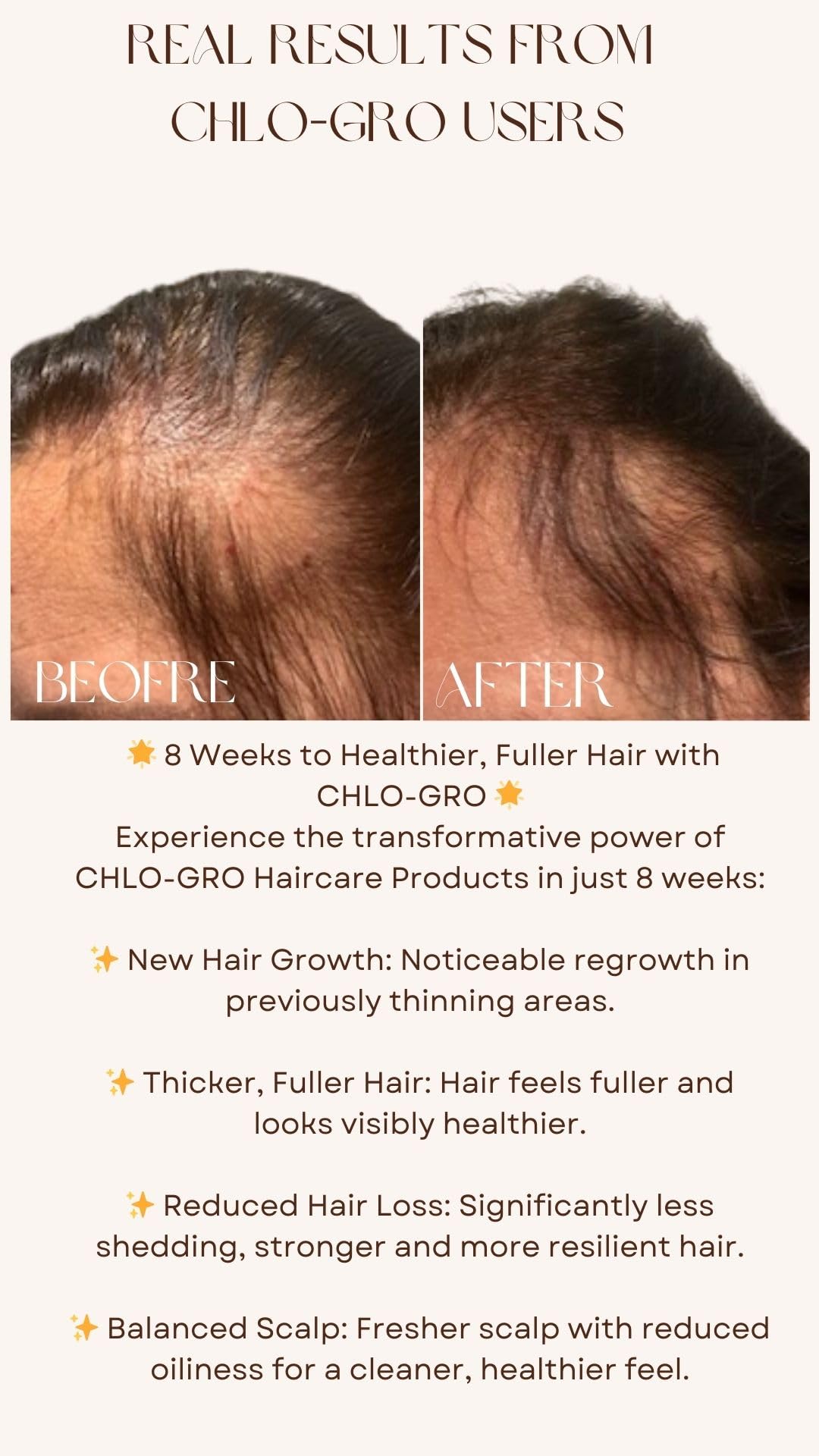 CHLO-GRO Hair Elixir, Hair Growth Serum, Promotes Thicker, Fuller Growth, Natural Scalp Serum for Men & Women with Argan Oil - Image 4