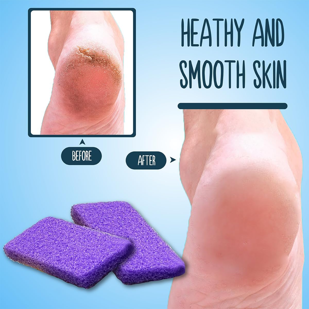 1600 PCS Disposable Foot Pumice Stone Bulk, Foot Scrubber for Dead Skin, Exfoliating Sponge for Feet, Callus Remover for Bath and Spa, 3.15 x 1.6 x 0.17 Inch (Purple)