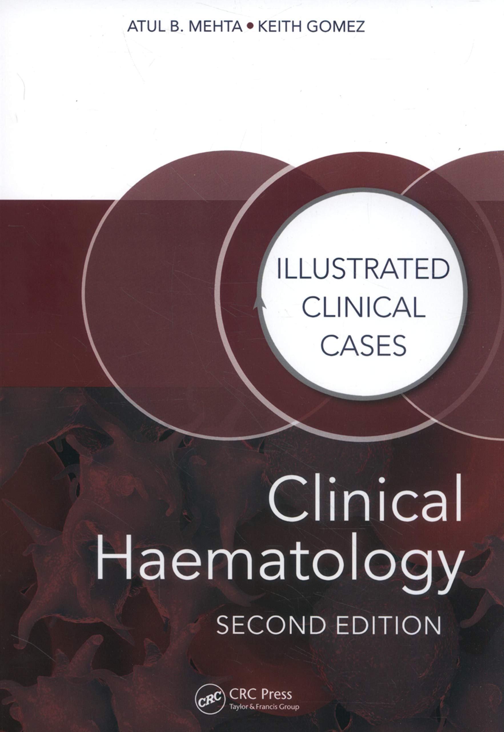 Clinical Haematology, Second Edition: Illustrat, Mehta, Gomez Paperb PB..