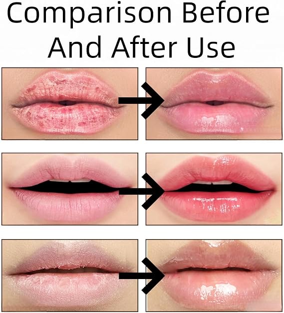 2PCS Lip Plumper & Boosting Serum – Hydrating Lip Moisturizer,Plumping Lip Gloss & Oil Set,Reduces Lip Lines,Locks In Moisture,Brightens & Repairs – Long Lasting Tinted Lip Balm for Everyday Lip Care