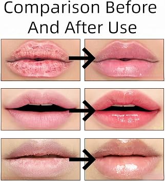 2PCS Lip Plumper & Boosting Serum – Hydrating Lip Moisturizer,Plumping Lip Gloss & Oil Set,Reduces Lip Lines,Locks In Moisture,Brightens & Repairs – Long Lasting Tinted Lip Balm for Everyday Lip Care