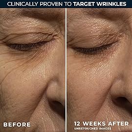 RoC Retinol Correxion Night Cream for Deep Wrinkles, Anti Aging Skincare Treatment Women and Men, 1.0 oz (Packaging May Vary)