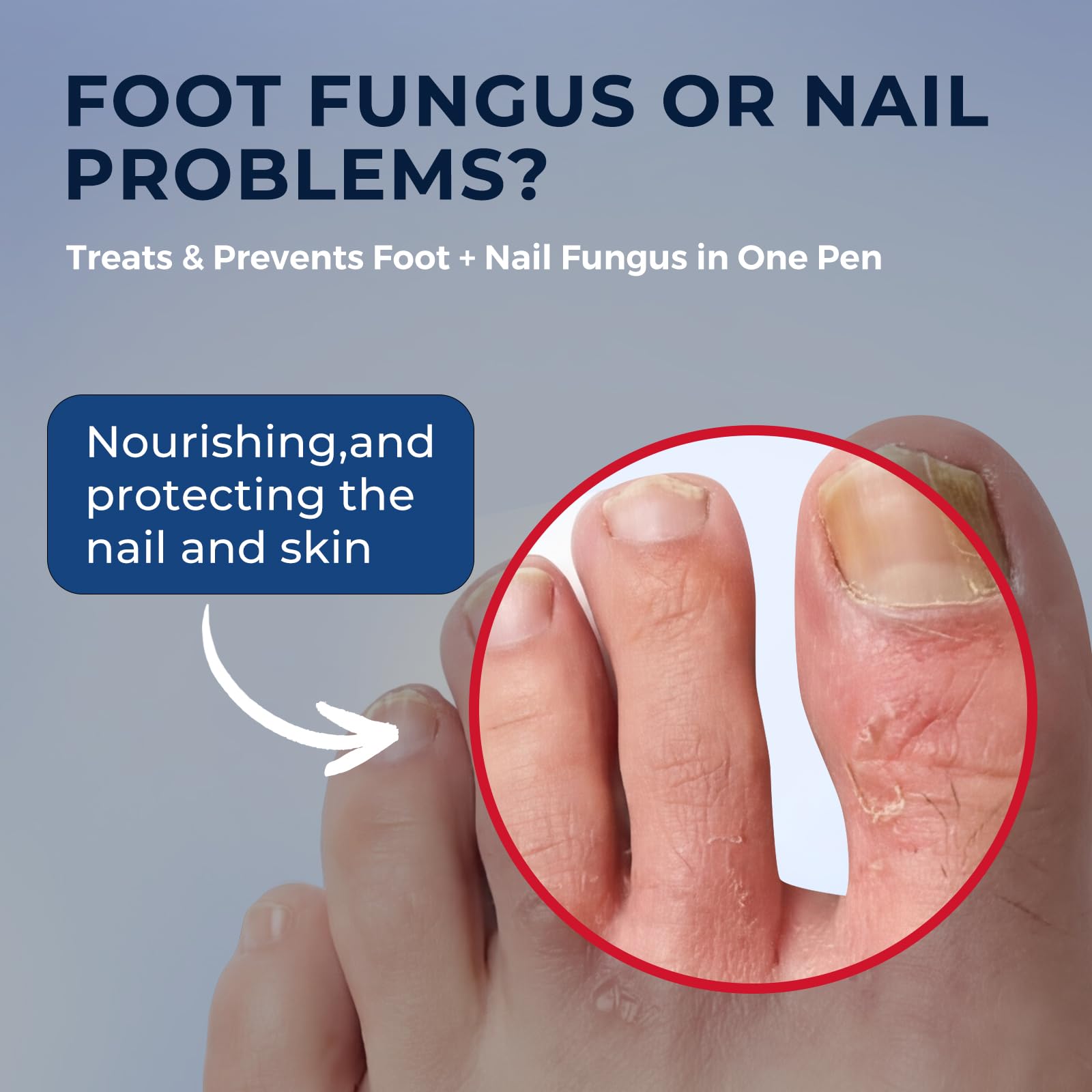Toenail Fungus Treatment Extra Strength Pen FSA-HSA Eligible, — Amazon image 2