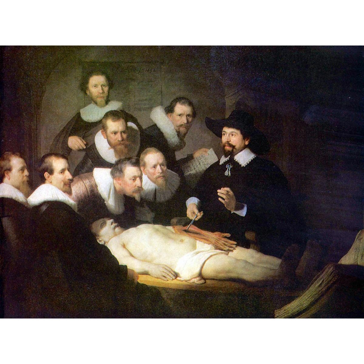 Anatomie du Dr Tulp par Rembrandt solution idéale pour habiller un cabinet médical