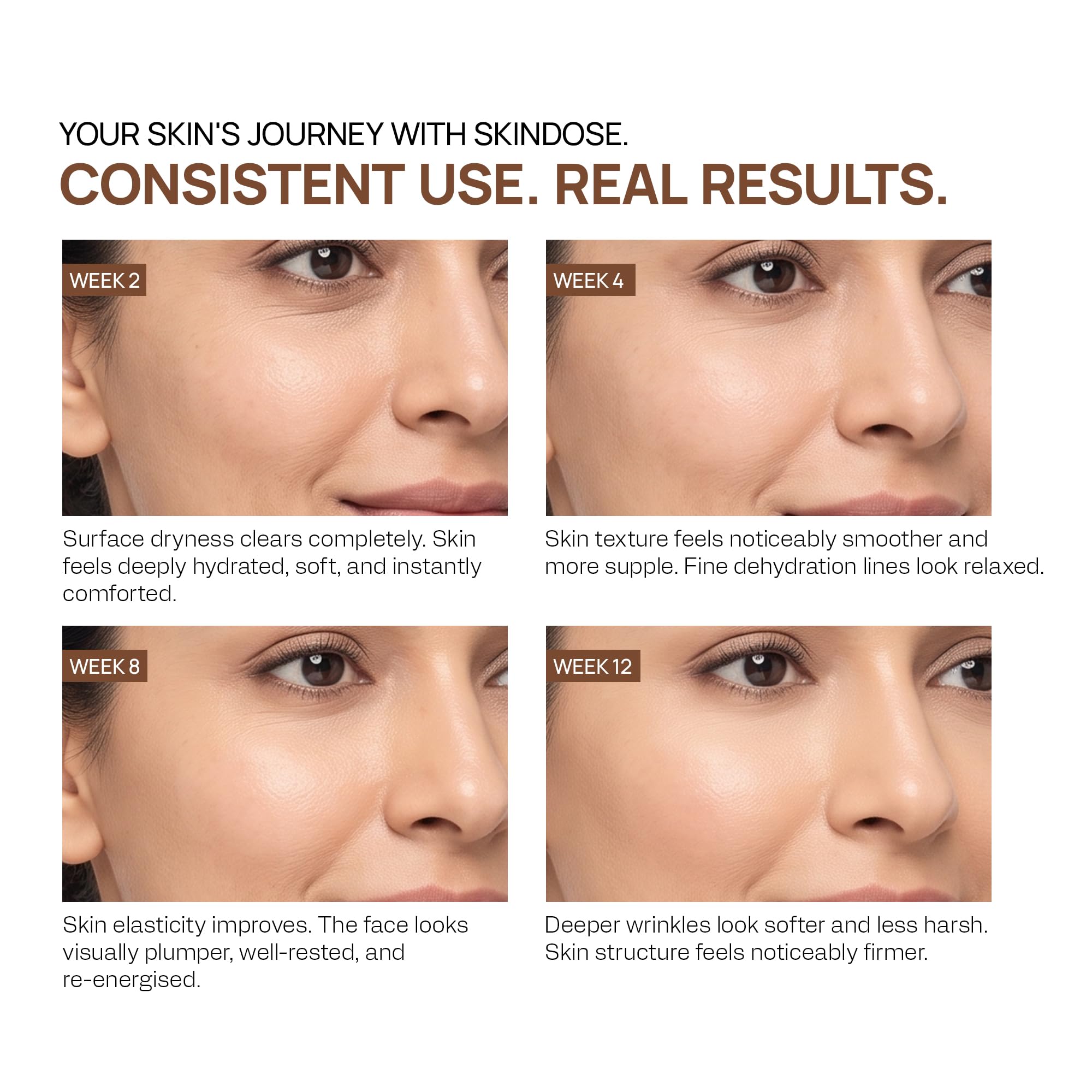 YUDERMA SKINDOSE TIME FILLER, 50 ml 3