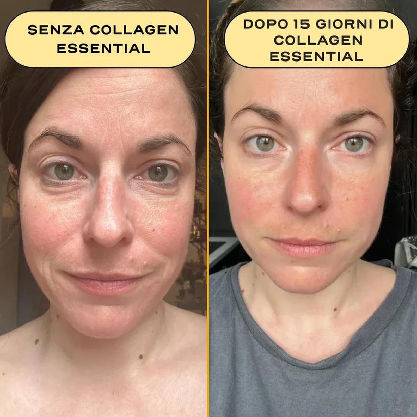 Pelle, Capelli e Unghie – Collagene Marino Puro Alto Dosaggio + Vitamina C | Potente Anti-Age, Articolazioni Flessibili e Bellezza dall’Interno | Gusto Neutro (Formato 30 Giorni New Pack)