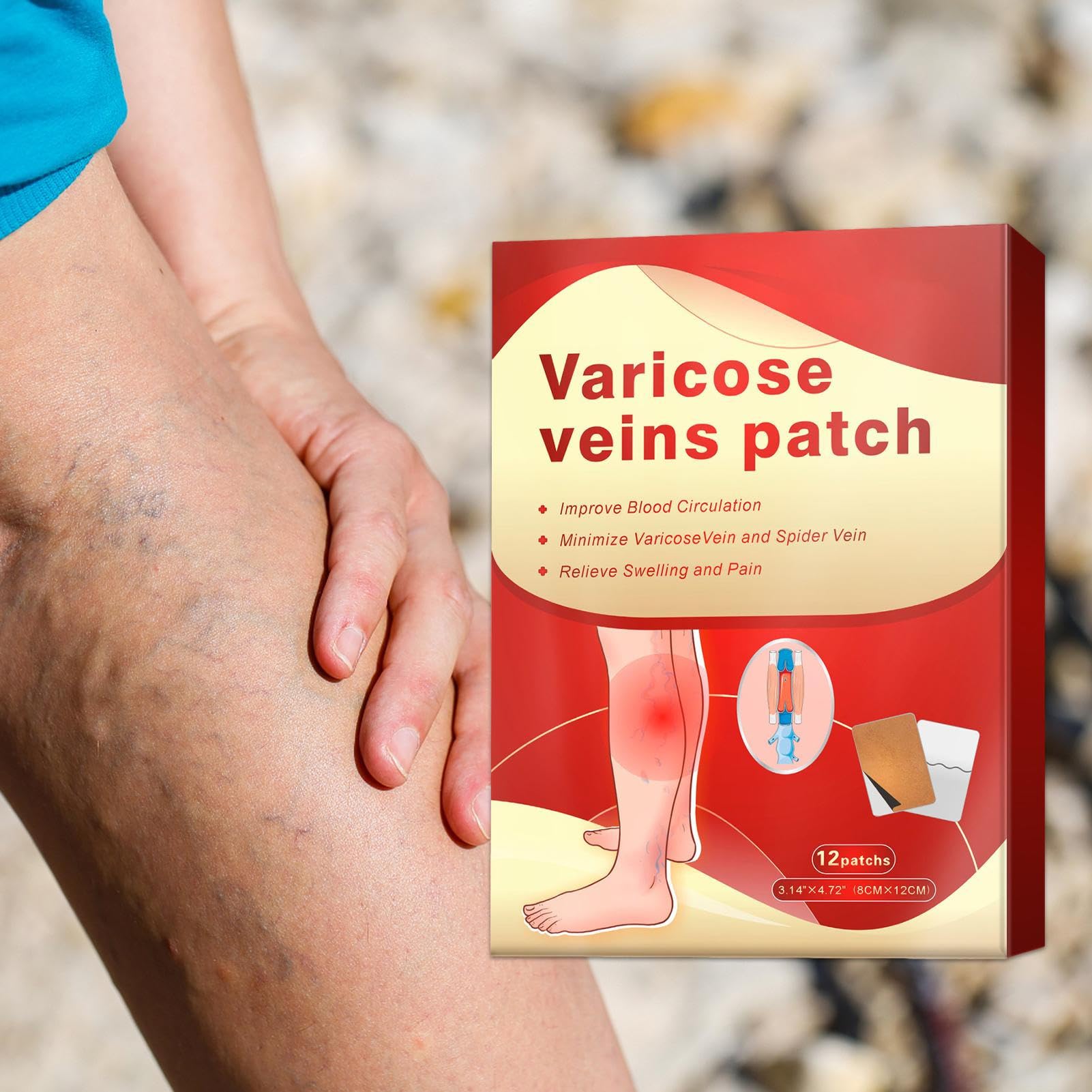 Parche de microagujas Vein Target: pasta para la circulación de 12 piezas, reducción de la hinchazón varicosa, aplicación externa para la salud, mejora la circulación, reduce la hinchazón de las piern