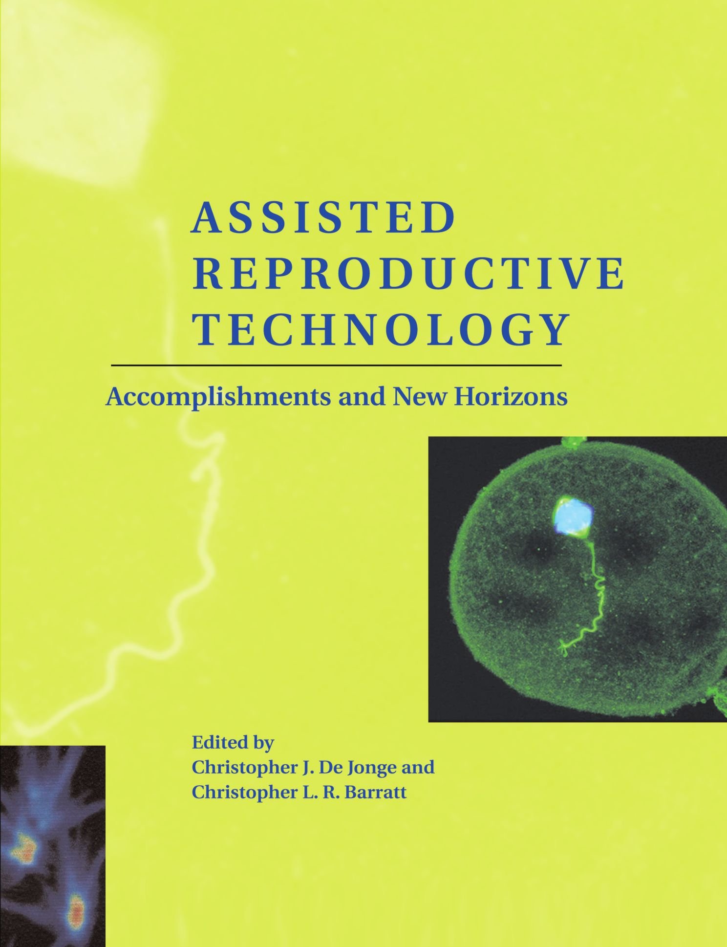 Assisted Reproductive Technology Accomplishments New… Paperback 9780521188951 VG