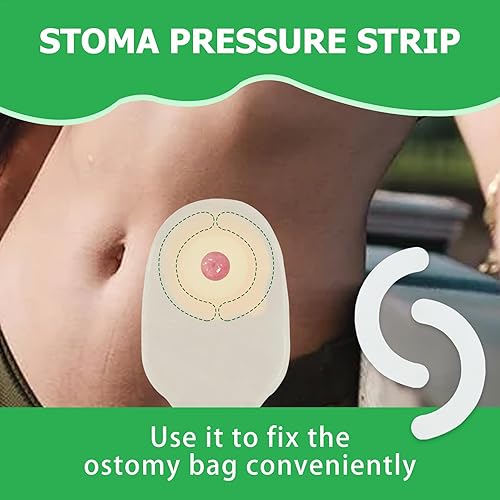 Miniatura 3 de 20 tiras de barrera para ostomía ZnnaYoha (no tejidas, 20 unidades)