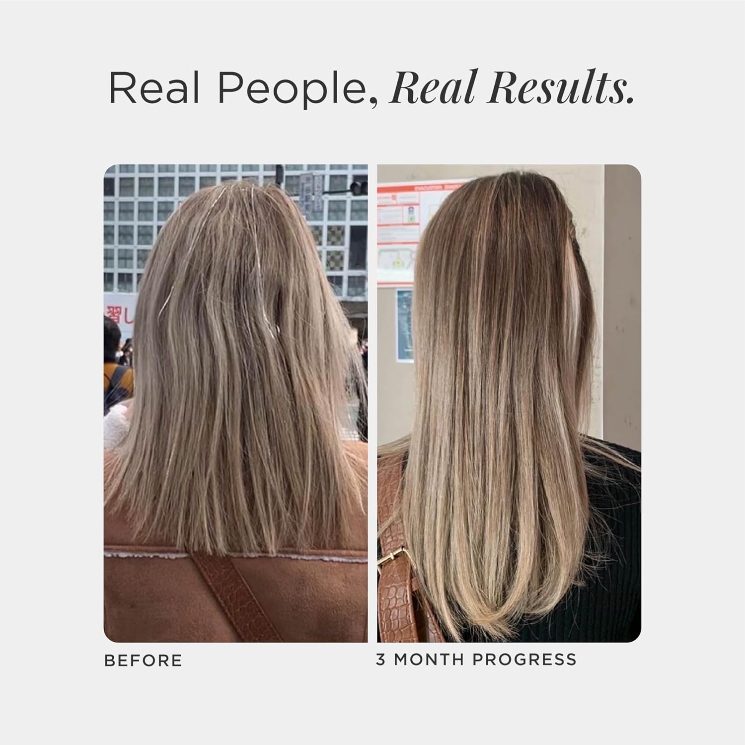 JSHealth Vitamins Hair and Energy Formula - Hair & Scalp Support Supplement with Iodine and Zinc - 30 Capsules - Image 3