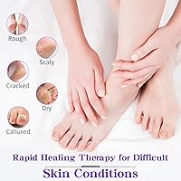 Vista 4 de Removedor de callos para pies, crema para manos y pies, loción para piel extremadamente seca, tratamiento de pies de atletas, productos de spa