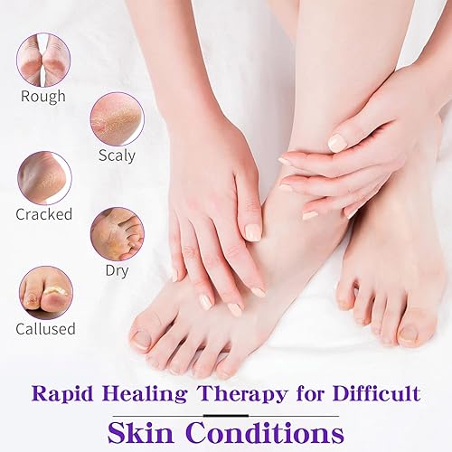 Miniatura 4 de Removedor de callos para pies, crema para manos y pies, loción para piel extremadamente seca, tratamiento de pies de atletas, productos de spa de