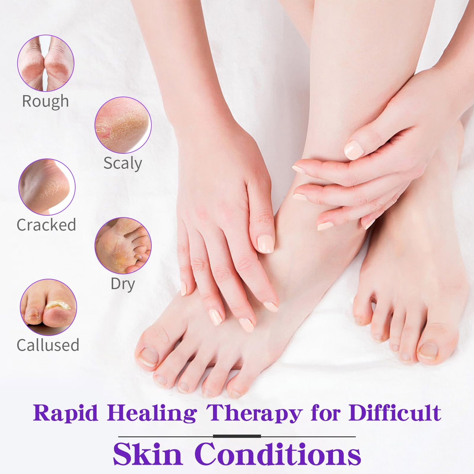 Foot Callus Remover, Hand & Foot Cream, Lotion for Extremely Dry Skin, Athletes Foot Treatment, Pedicure Foot Spa Products for Dry Hands, Cracked Feet, Rough and Dry Skin, 80ml Lavender