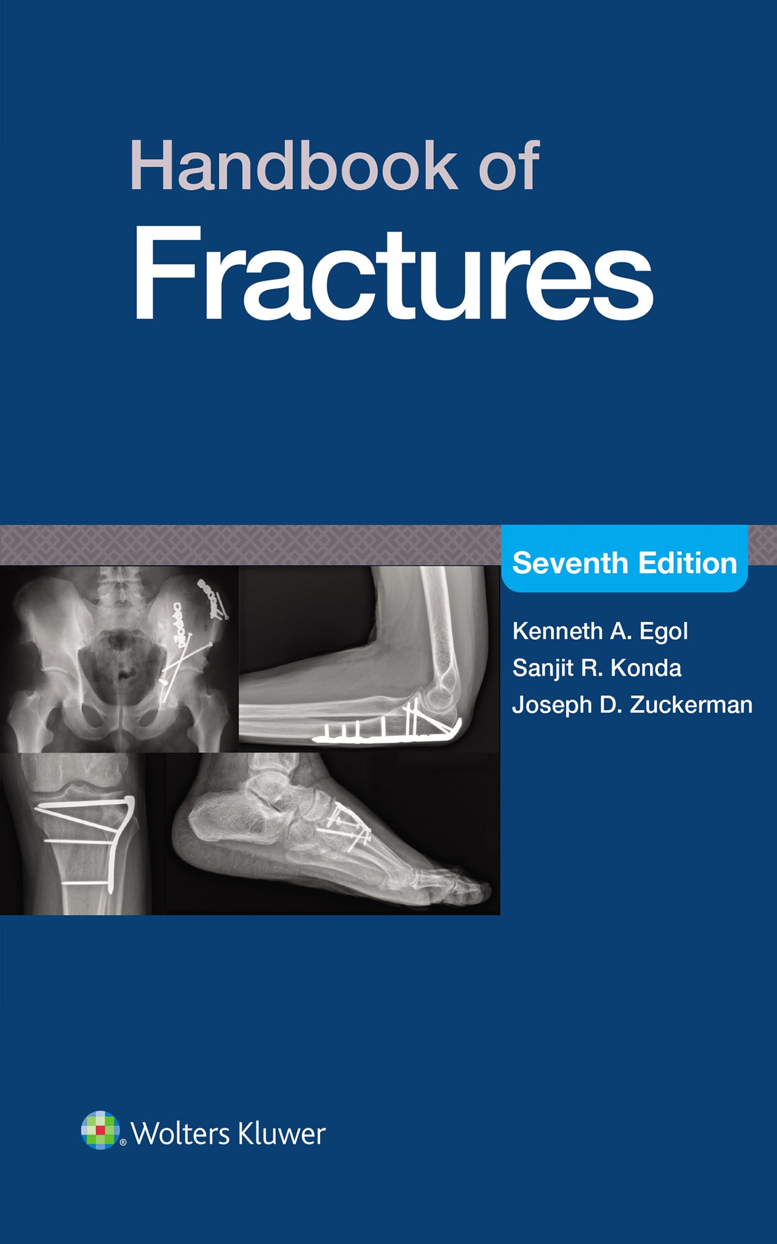 Handbook of Fractures: eBook without Multimedia (English Edition)