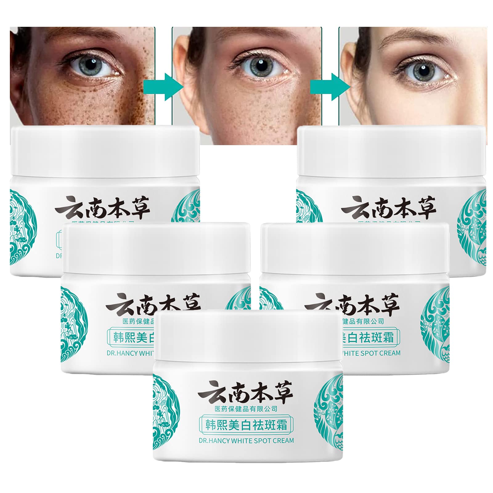 Generic Kirozi Japanese Melasma Cream, 20g Kirozi Japanese Cream for Face, Kirozi Melasma Cream Made in Japan, Herbal Skin Care Cream (5pc)