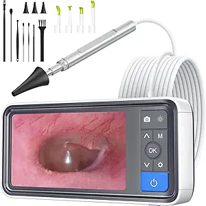 ScopeAround Otoscope Ear Camera with 4.5" IPS Screen, 1920x1080 FHD Smart Visual Ear Cleaner with Camera Tool Kit, Plug & Play at Home Ear Infection Detector Ear Wax Removal Camera with Light