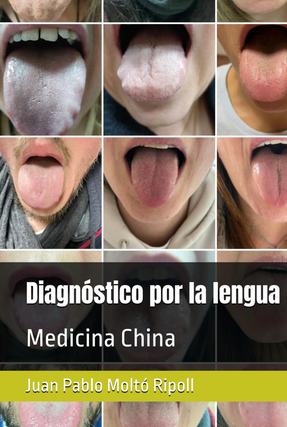 Diagnóstico por la lengua: Medicina China (Spanish Edition)