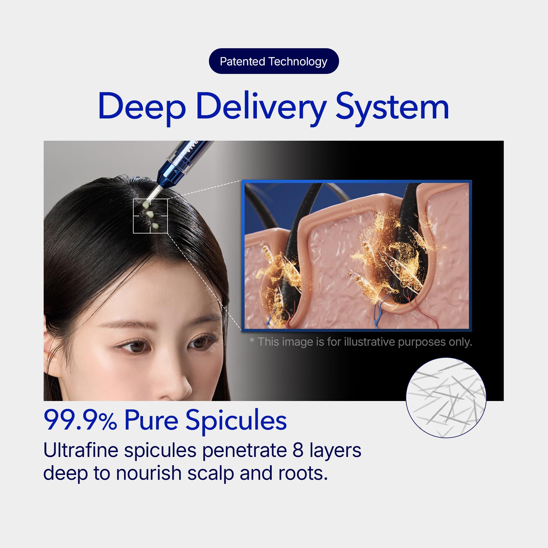 Amazon | ViveLab スカルプマイクロニードルセラム – K-beauty 育毛