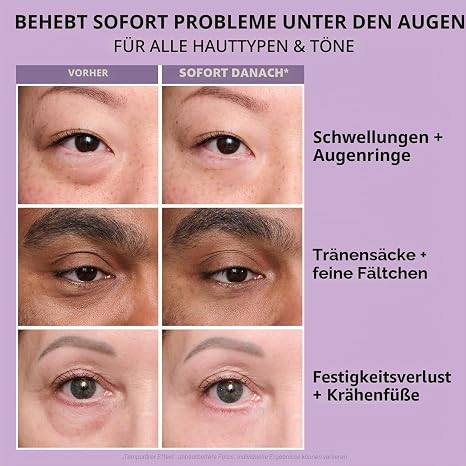Holoras 20 g Perfection Eye Tightener with Brush Firming Cream Eyes Instant Eye Tightener Eye Tightener Temporary Eye Tightener Gentle Skin Care for the Eye Area (2)