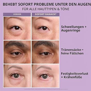 Holoras 20 g Perfection Eye Tightener with Brush Firming Cream Eyes Instant Eye Tightener Eye Tightener Temporary Eye Tightener Gentle Skin Care for the Eye Area (2)