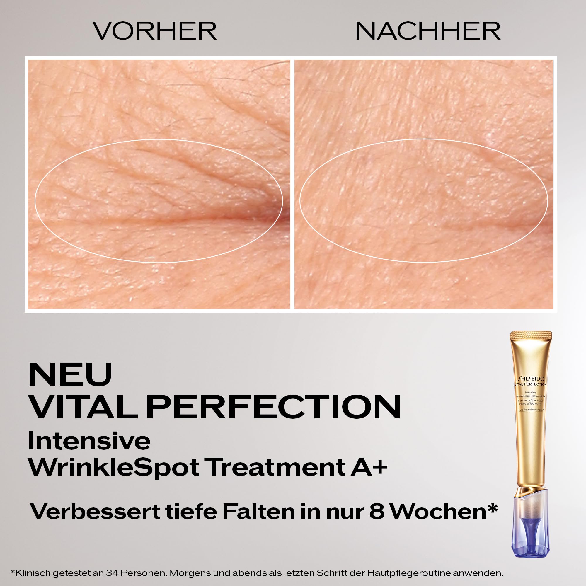Shiseido Vital Perfection Intensive WrinkleSpot Treatment A+ 20 ml | Anti-Falten-Pflege, Retinol für Gesicht & Hals, Anti Aging gegen Pigmentflecken und Tiefe Falten, Japanische Hautpflege