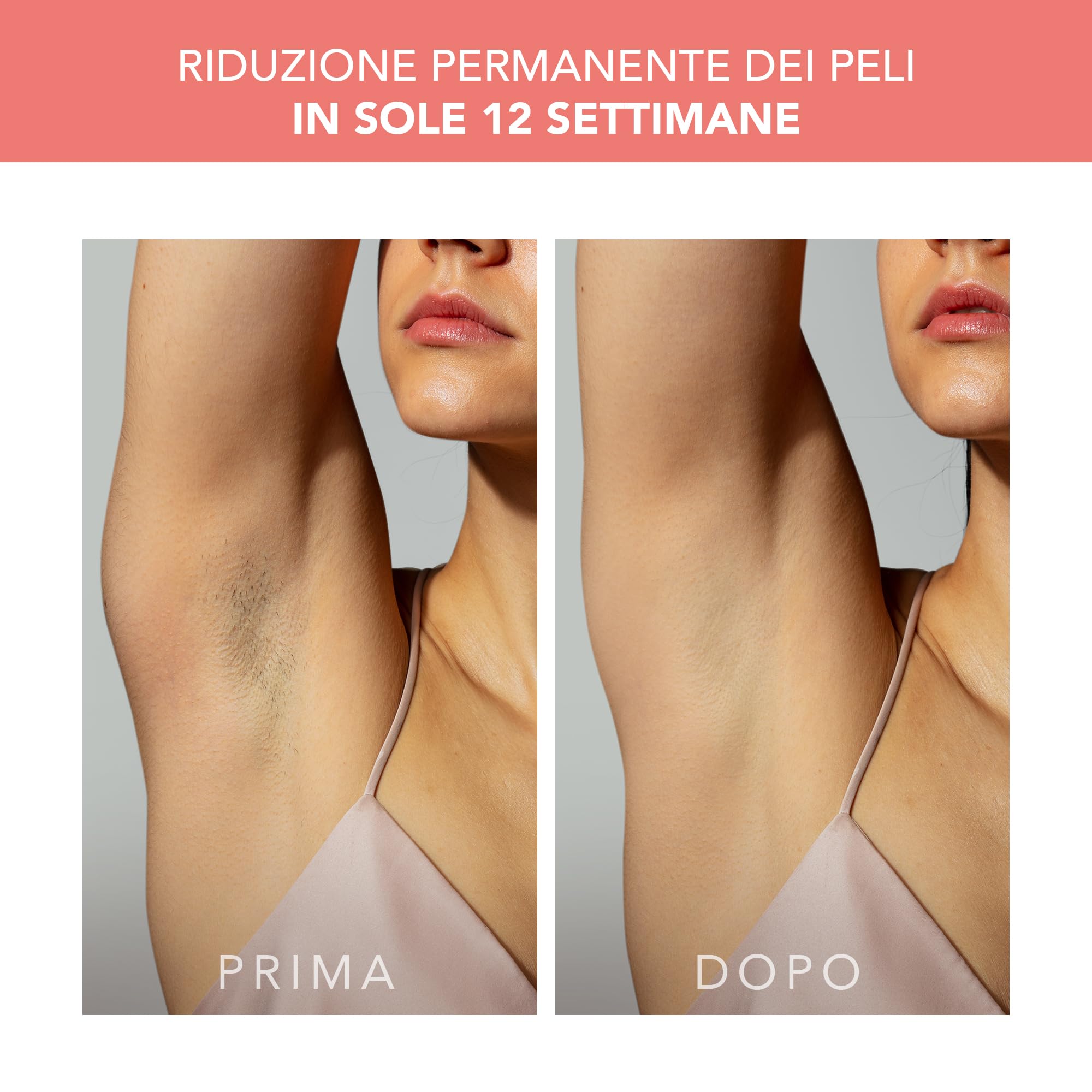 FOREO PEACH 2 IPL, Epilatore Luce Pulsata Professionale, Alternativa per Epilatore Laser e Depilazione Laser, Epilazione Permanente Viso e Corpo, 10 min Trattamento, con Cavo | Epilazione IPL E Laser, Viso E Bikini, Raffreddamento Cutaneo, Peli Incarniti,