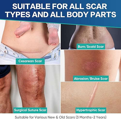 Miniatura 4 de Hojas de cicatriz de silicona de grado médico, 20 unidades (10 x 4 x 4 + 10 x 1.2 x 6), tratamiento de cicatrices de doble tamaño para cicatrices
