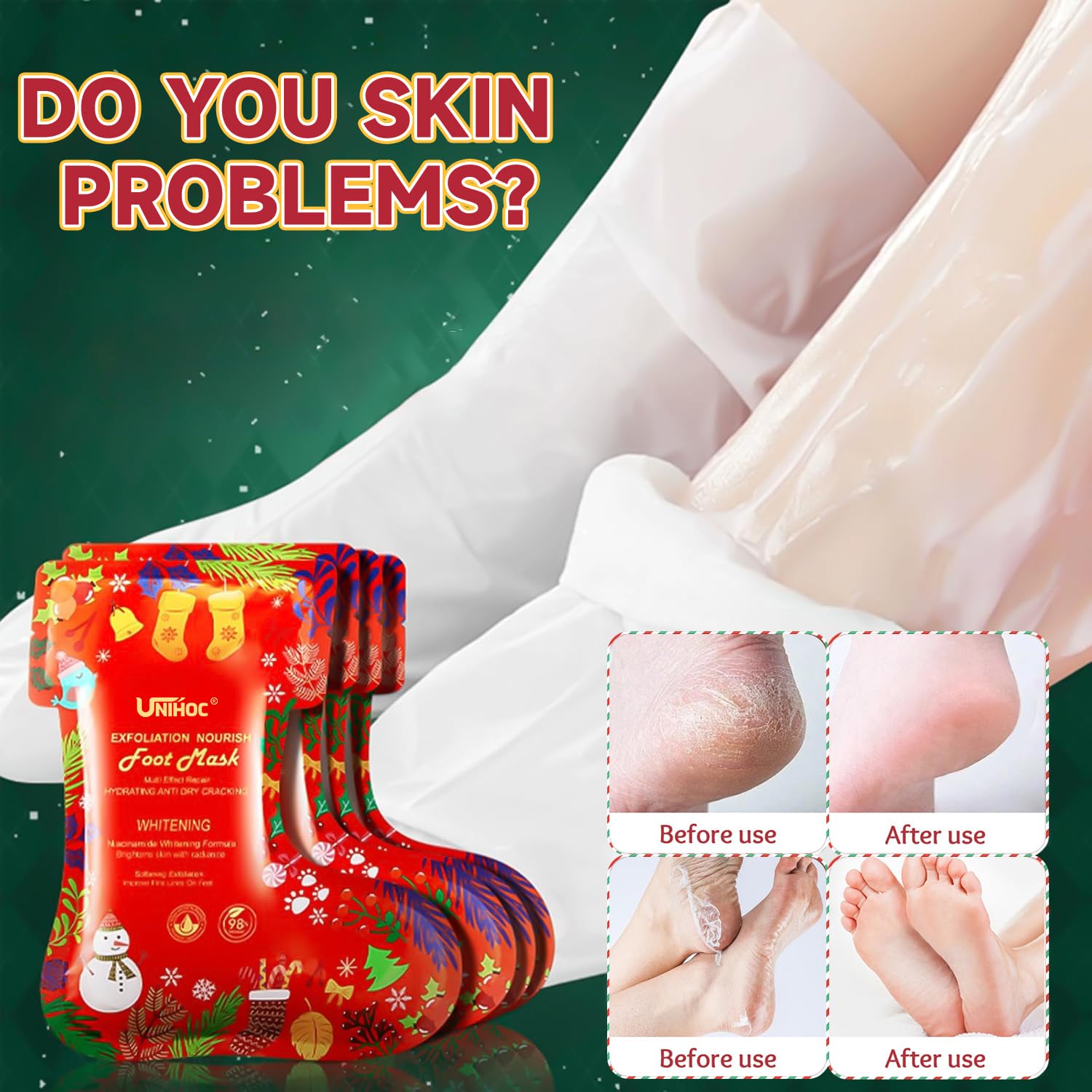 5 Paia Maschera Piedi Natale, Maschera Idratante Piedi, Maschera Piedi Esfoliante E Idratante, Rimuove Efficacemente i Calli e Ammorbidisce le Cuticole, Rendendo la Pelle Più Liscia