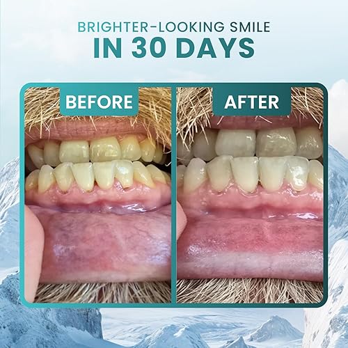 Miniatura 3 de Larineco - Goma remineralizante con nanohidroxiapatita y xilitol, goma de mascar de xilitol sin azúcar, sin plástico, sin colorantes, sin aspartamo,