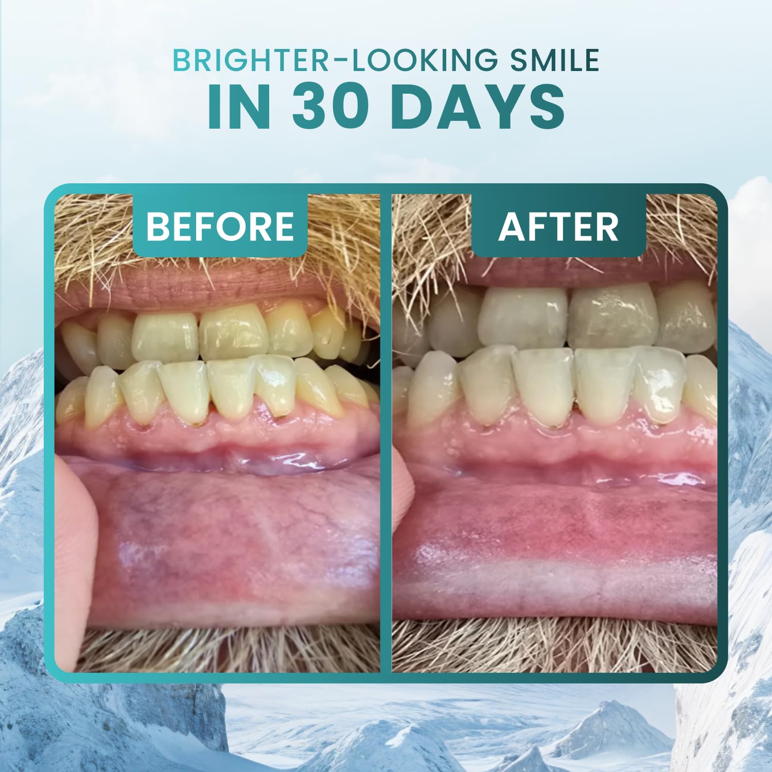 Larineco Remineralizing Gum with Nano Hydroxyapatite Xylitol Sugar-Free Xylitol Gum Plastic-Free Dye-Free Aspartame-Free Natural Base 36 Pieces Mastic — view 3