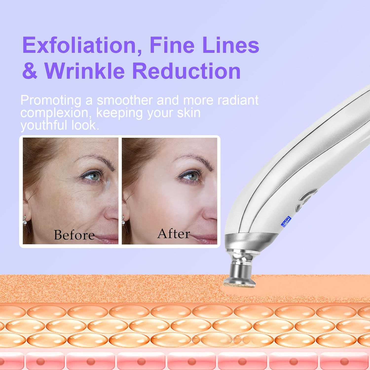 Personal Microdermabrasion Machine, Rechargeable Suction Microderm Facial Device with 9pcs Diamond Dermabrasion Head and 5 Levels for Professional Face & Body Skin Care Salon Home Use - Image 3