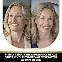 Vista 3 de VALITIC Brightening Jabón de ácido kójico de limón y cúrcuma, vitamina C, retinol, complejo japonés original con ácido hialurónico, vitamina E