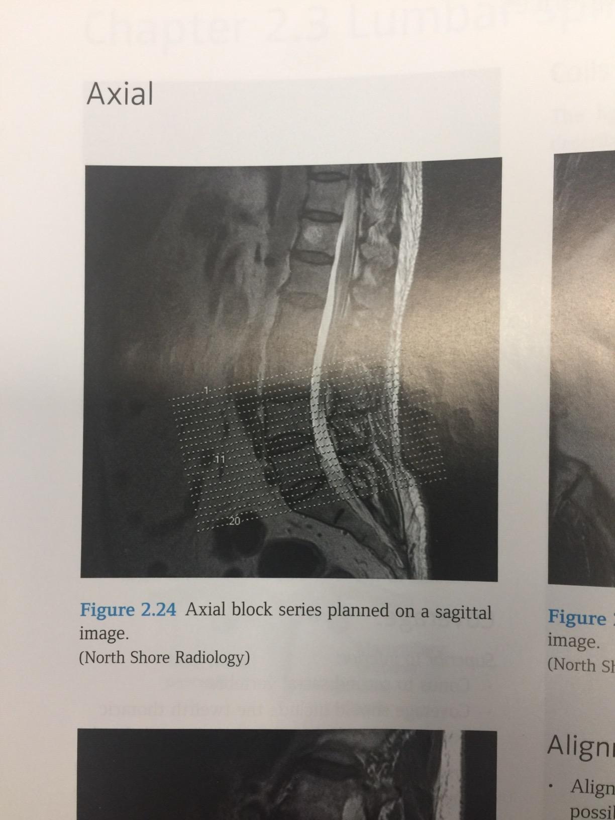 Anne with an E visual data 5