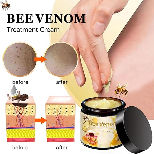 Miniatura 2 de Crema de veneno de abeja, crema de veneno de abeja, crema profesional de reparación de veneno de abeja, crema natural de veneno de abeja para todas