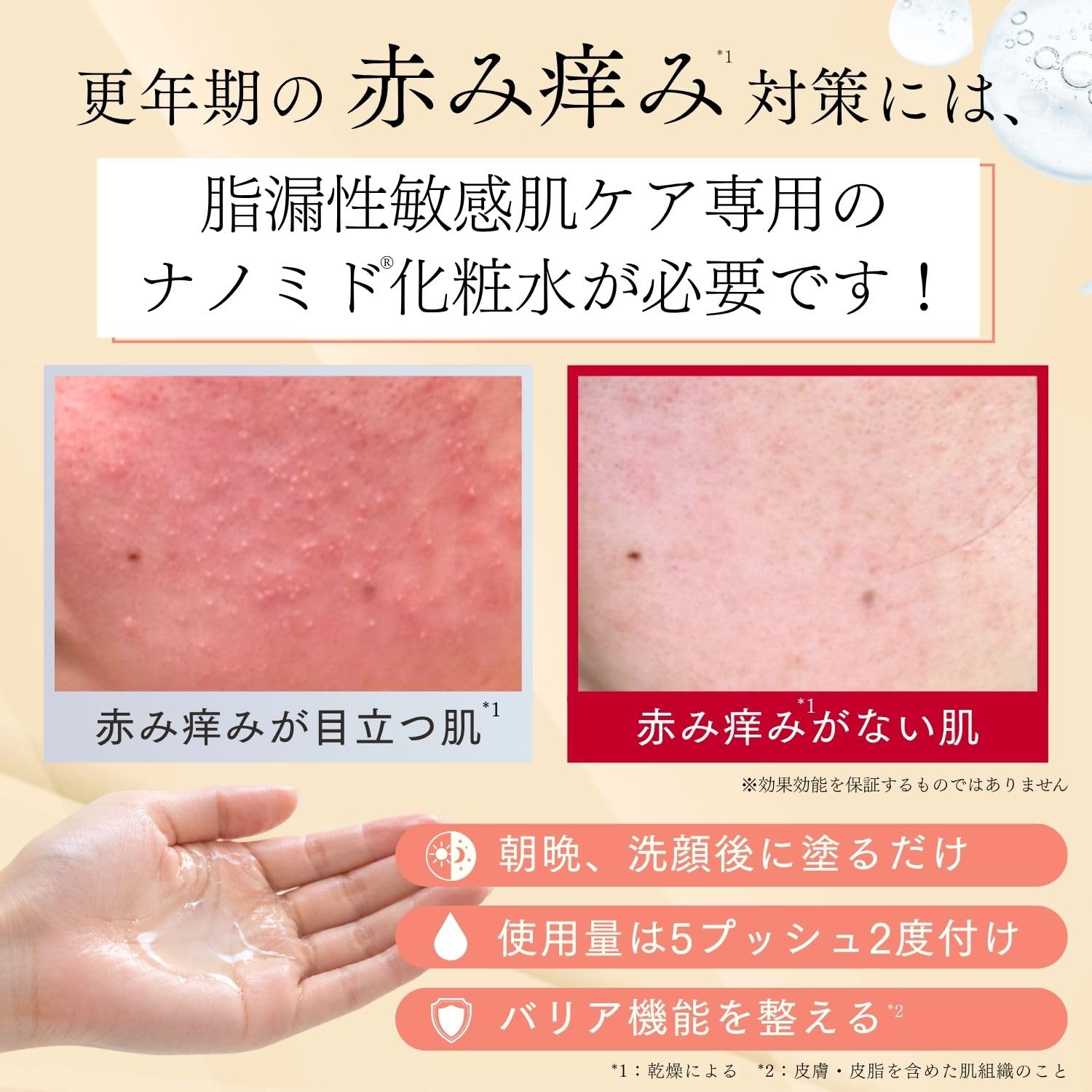 Amazon | 突然の赤み痒みに クレチュール ジュレローションEX ナノミド