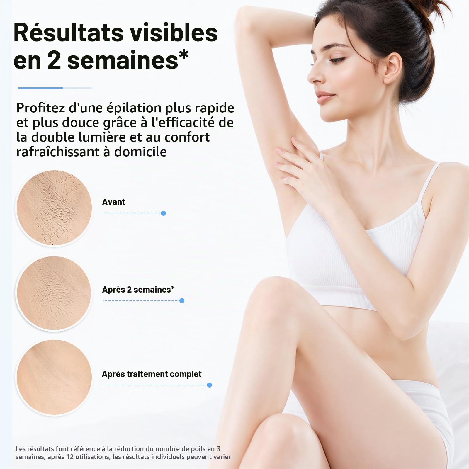 Epilateur Lumiere Pulsee IPL – 999 999 Flashs, SHR/AUTO, 3 Intensités