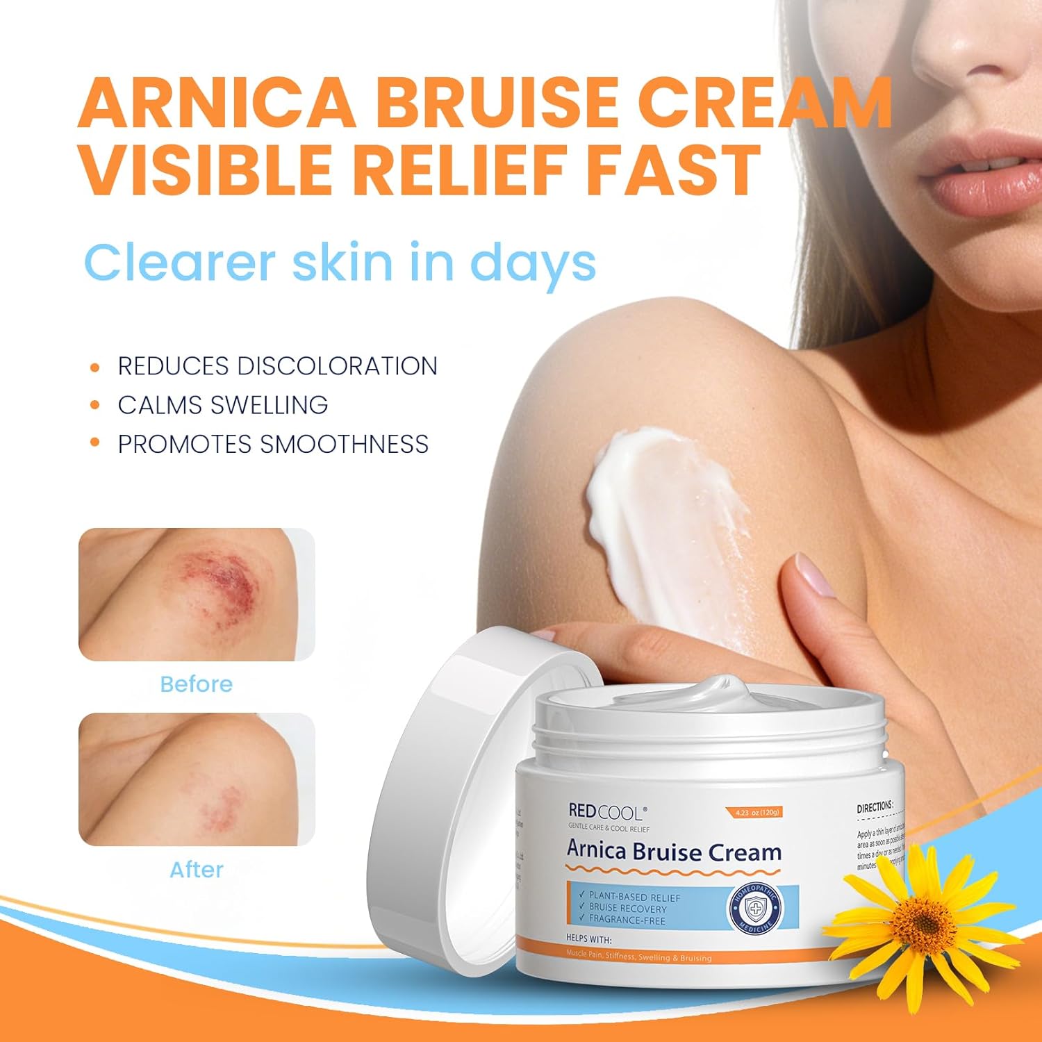 Arnica Cream Extra Strength for Thin Skin, Arnica Montana Cream with Vitamin K C & E, Fast Absorbing Hydrating Cream for Face and Body, Supports Skin Recovery Appearance, 4.23 oz