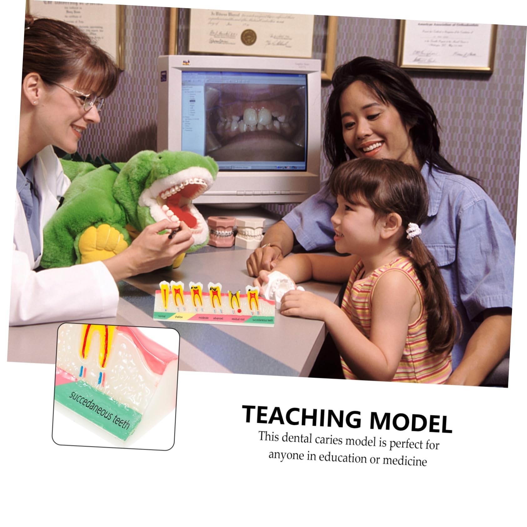 OUNONA Modello Dentale Portatile in Resina per Educazione Orale Aspetto Creativo e Leggero per Scienze e Didattica Dentale