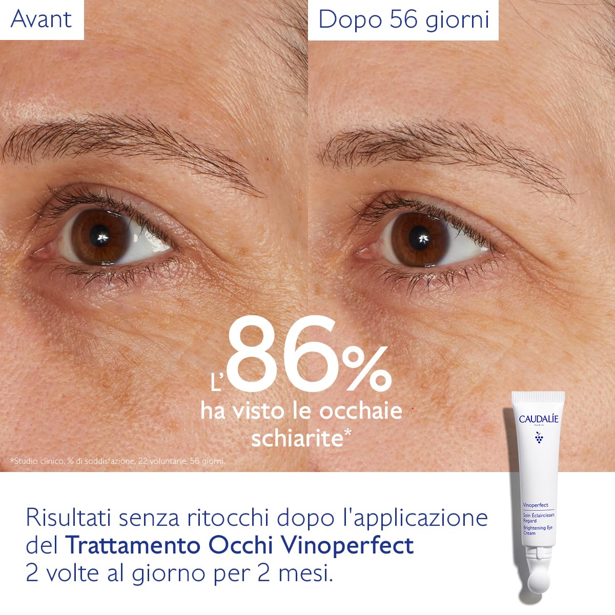 Caudalie Vinoperfect Trattamento Illuminante Occhi con Caffeina + Niacinamide - 15 mL