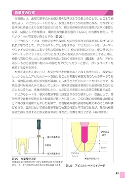 気内療法学 5冊セット 歯内治療学 第5版／医歯