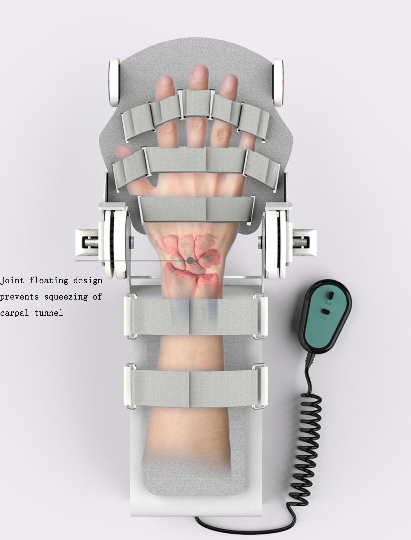 Dispositivo Elettrico per la Riabilitazione dell'articolazione del Gomito, Stecca stabilizzatrice per tutore del Gomito Post operatorio Regolabile, Allenamento per la flessione del Palmo e tendini p