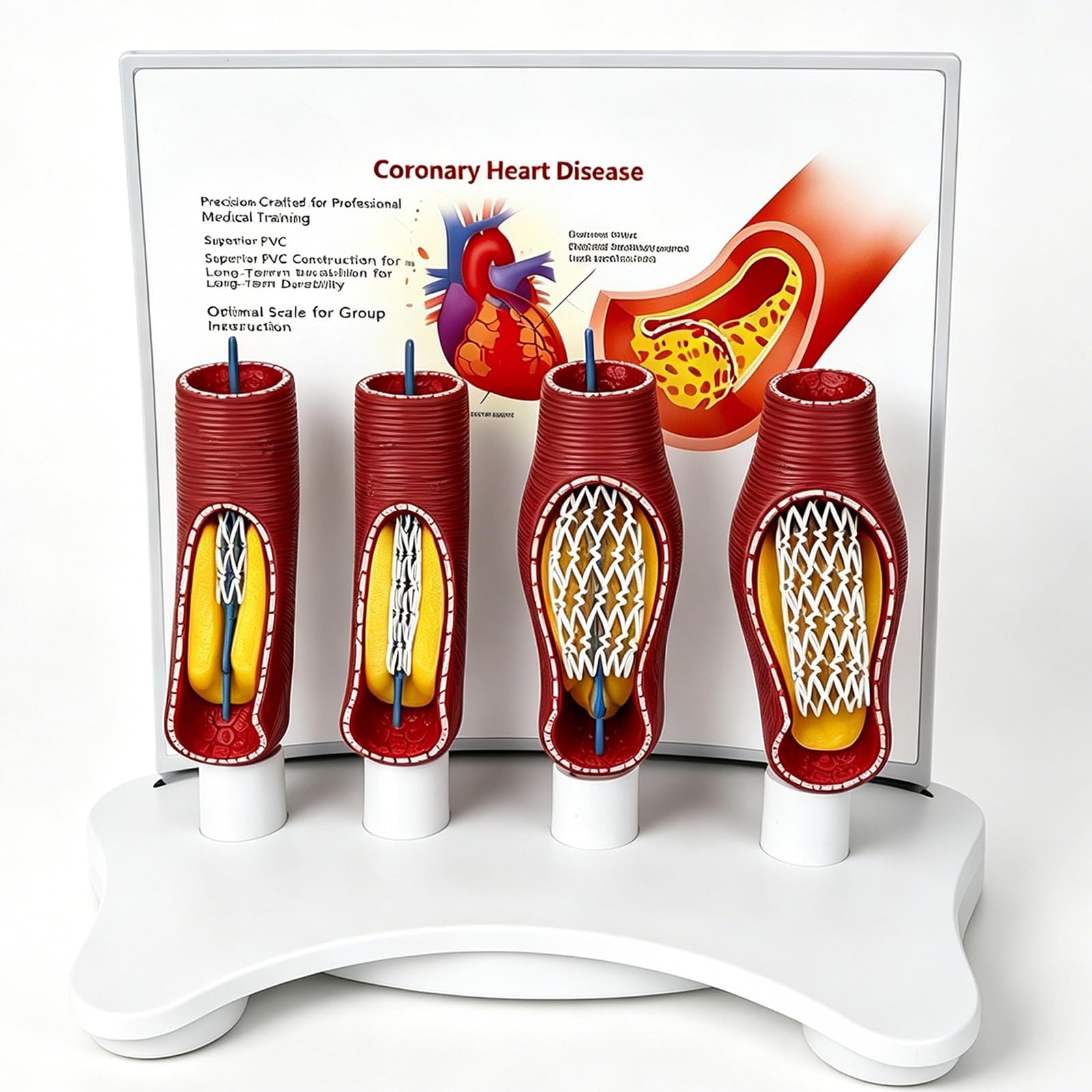 TQPGJJL Vascular Stent Model Gift for Medical Students Doctors – Anatomical Human Coronary Artery Model, Enlarged PVC Cardiology Teaching Tool for Office Desk or Graduation Present