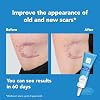 KELO-COTE Scar Care Gel for Kids, Post-Surgery, Scar Care Supplies, 0.2 oz (6 g)