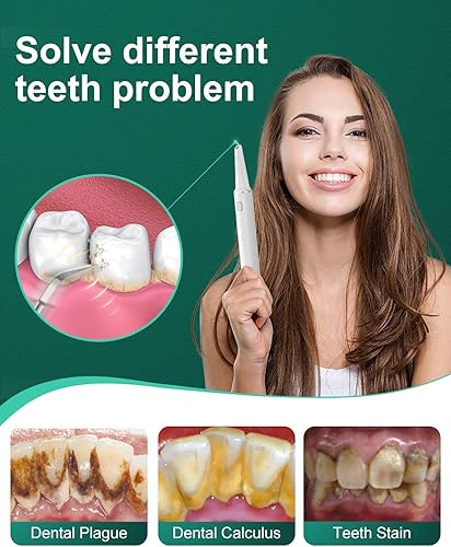 Miniatura 6 de Kit de limpieza de dientes, removedor de placa para dientes, herramienta portátil para quitar placa dental con LED, blasador de placa para dientes