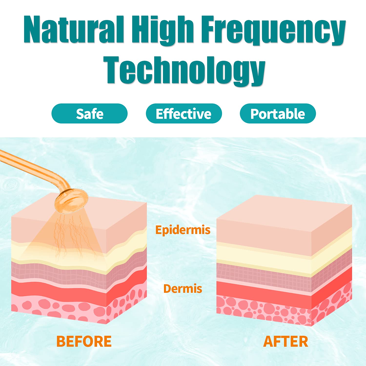 High Frequency Facial Wand - TUMAKOU Portable High Frequency Facial Skin Machine - with 4 Glass Tubes : Beauty & Personal Care